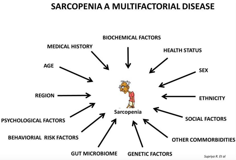 Sarcopenia, una enfermedad no atendida ni debidamente entendida