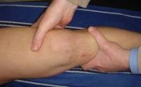 Rehabilitación del paciente con lesión del ligamento cruzado anterior de la rodilla (LCA). Revisión