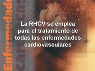 Video de Rehabilitación Cardiovascular para pacientes...