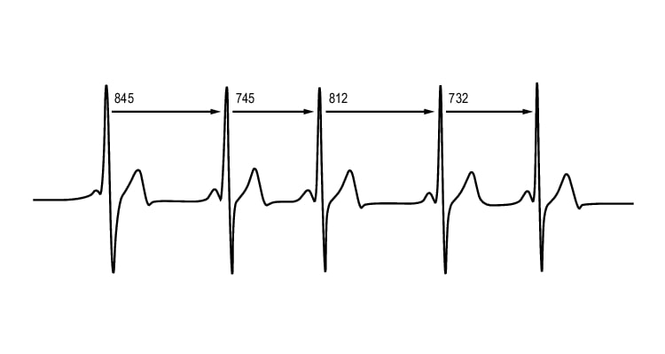 Cardiotacómetro como instrumento alternativo del ECG en el T4s